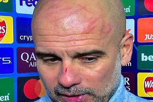 Σάλος με τον Γκουαρντιόλα που... μαζεύει όσα είπε αφού εμφανίστηκε ματωμένος μετά το ματς με τη Φέγενορντ (video)